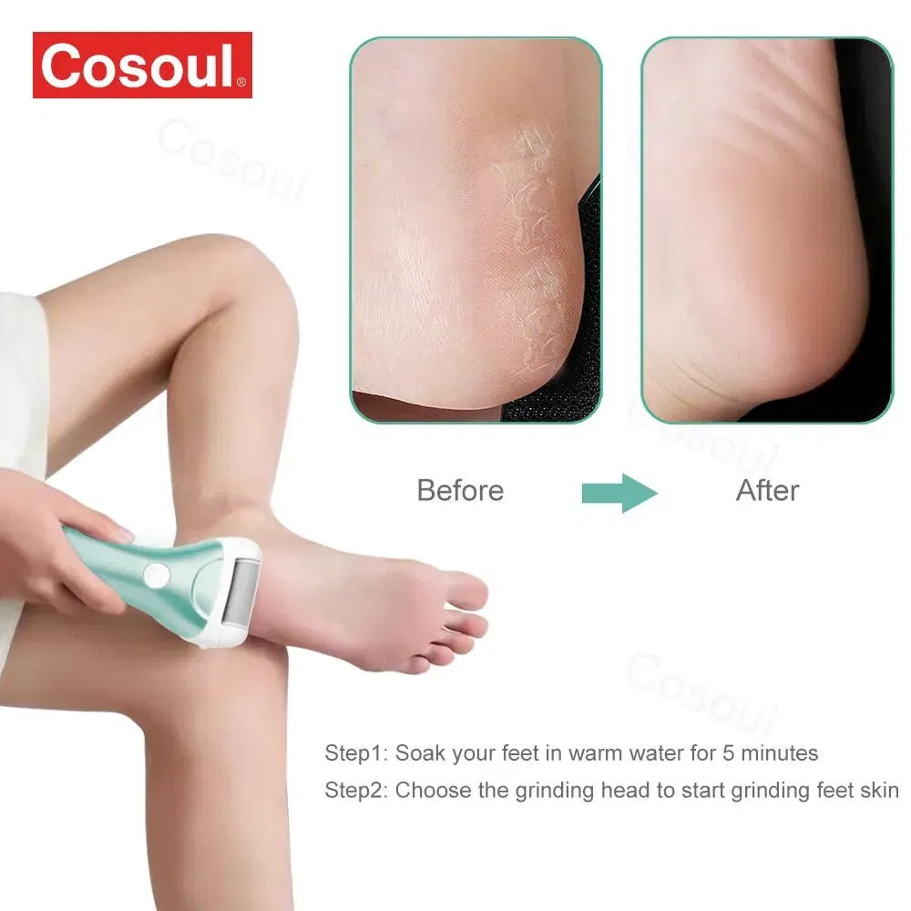 Color: Green - Electric Foot File Pedicure Tools Feet Callus Removers Rechargeable Foot Scrubber Feet Care for Dead, Hard Cracked Dry Skin