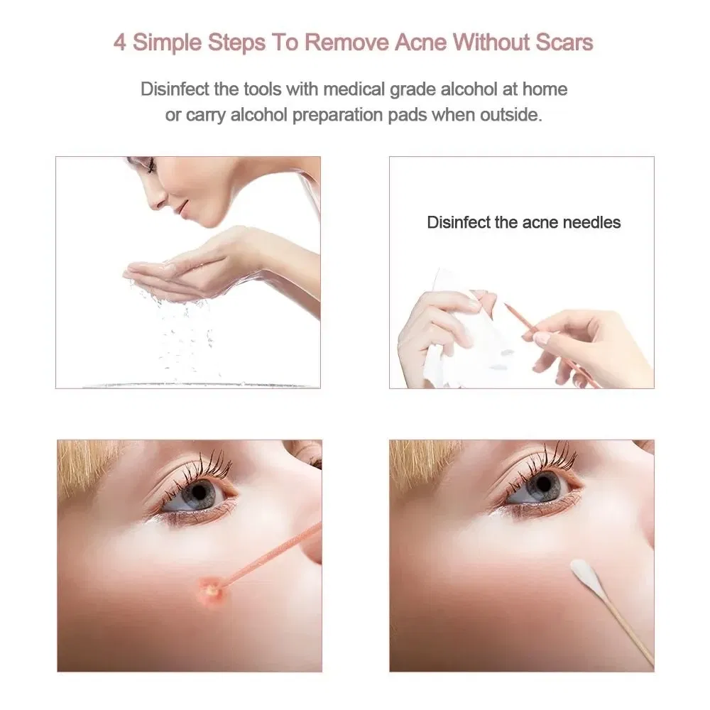 Color: WHITE - 4PCS Stainless Steel Acne Needle Electroplating Colorful Rose Gold Acne Needle Extrusion Blackhead Tool Can Be Customized LOGO