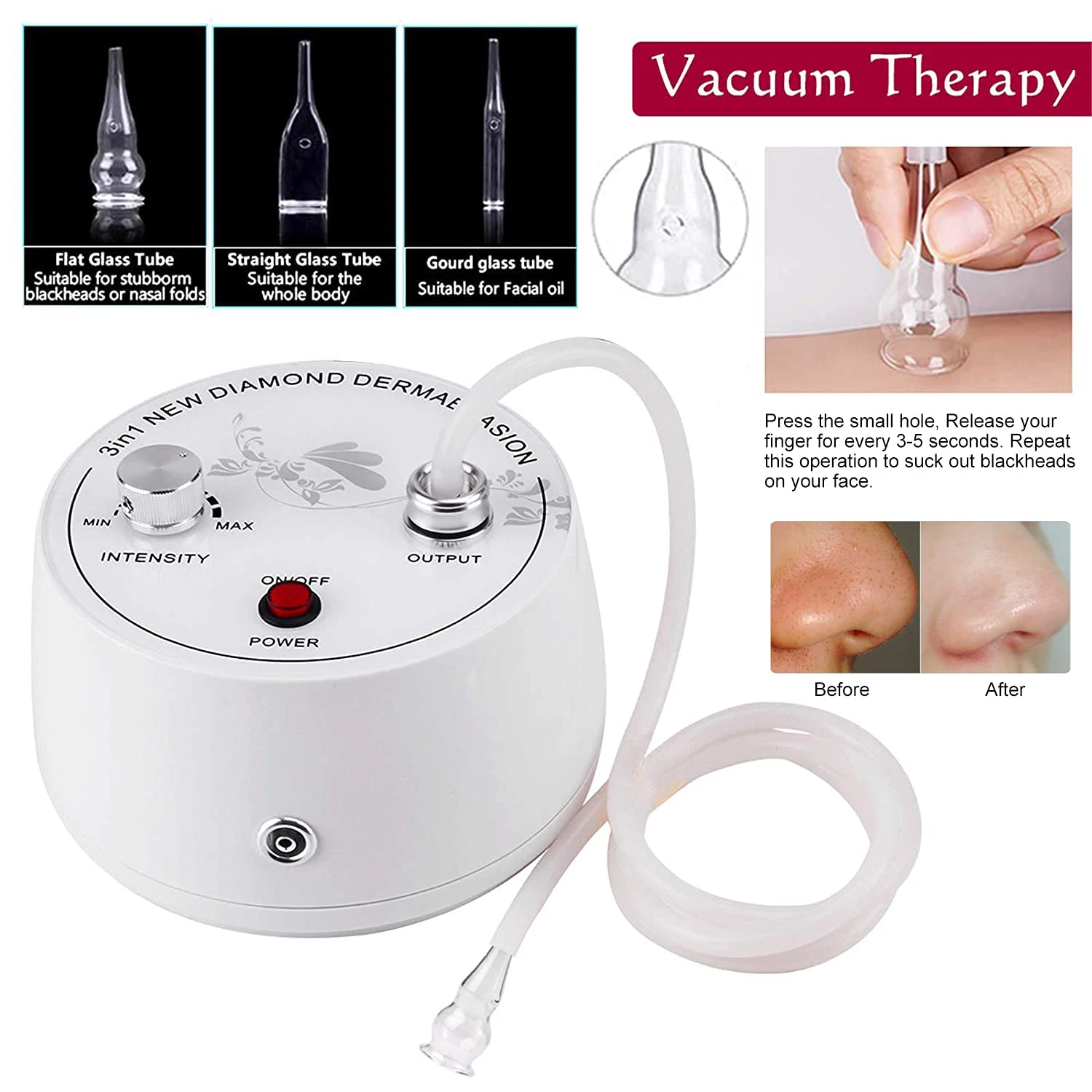 Color: Pink, Ships From: CHINA - Professional Diamond Microdermabrasion Machine For Facial Peeling Skin Care Blackhead Removel Water Spray Exfoliation Machine