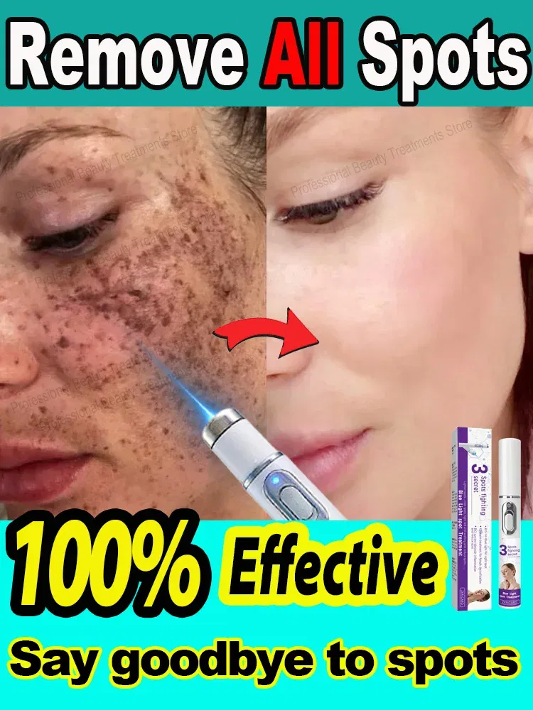 Color: green - ?โฆ?ยซ๐๐?ยค๐ฅ๐ ?ยซ๐?ยฆ๐จ๐ฏ๐๐ฅ Laser Therapy to Heal Spots