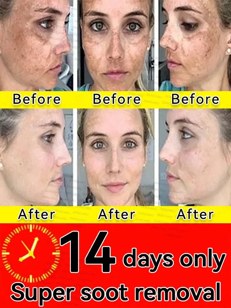 Color: green - ?โฆ?ยซ๐๐?ยค๐ฅ๐ ?ยซ๐?ยฆ๐จ๐ฏ๐๐ฅ Laser Therapy to Heal Spots