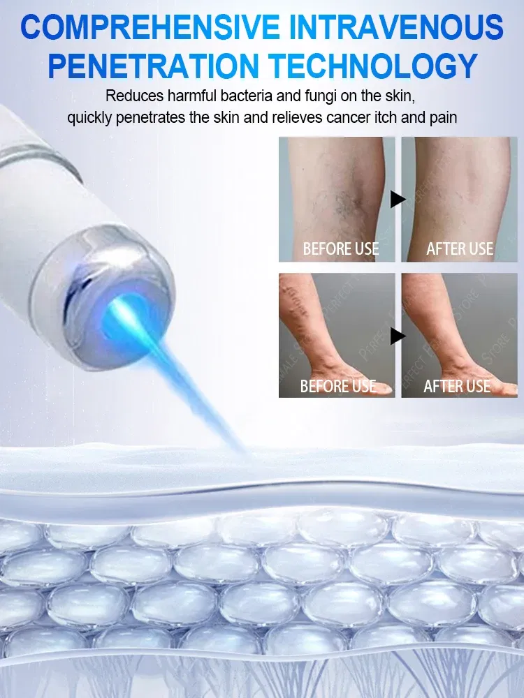 Color: Blue - Varicose Veins Products