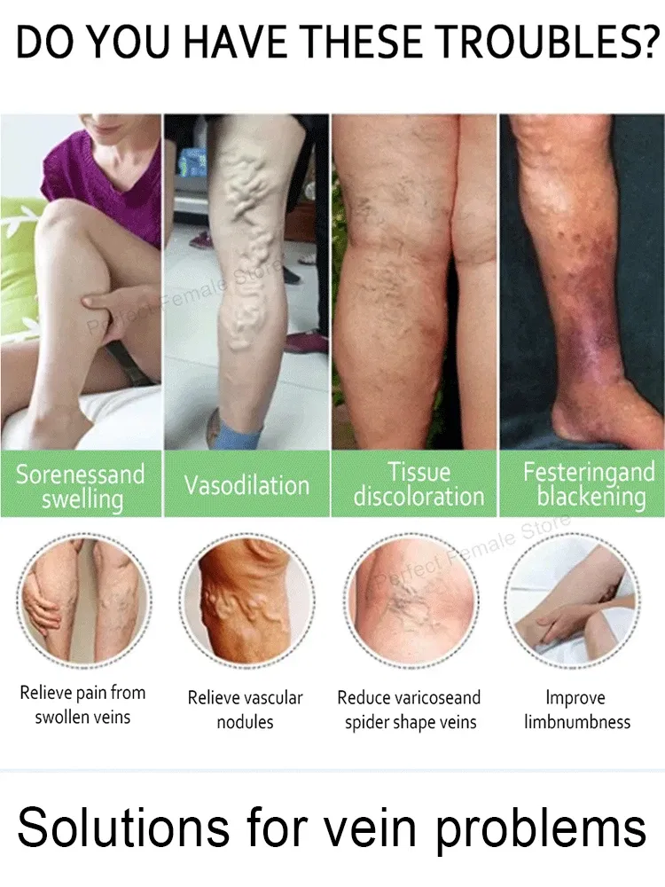 Color: Blue - Varicose Veins Products