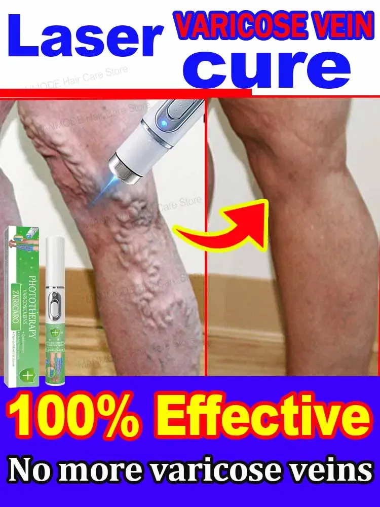 Color: green - Varicose Veins Products