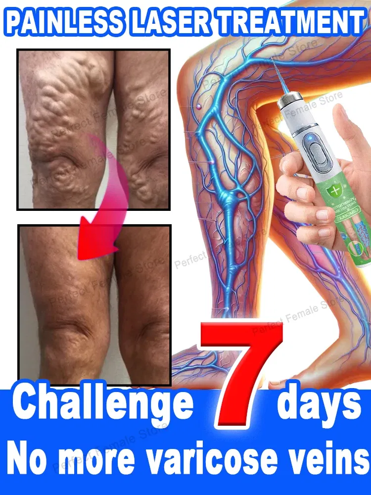 Color: green - Varicose Veins Products