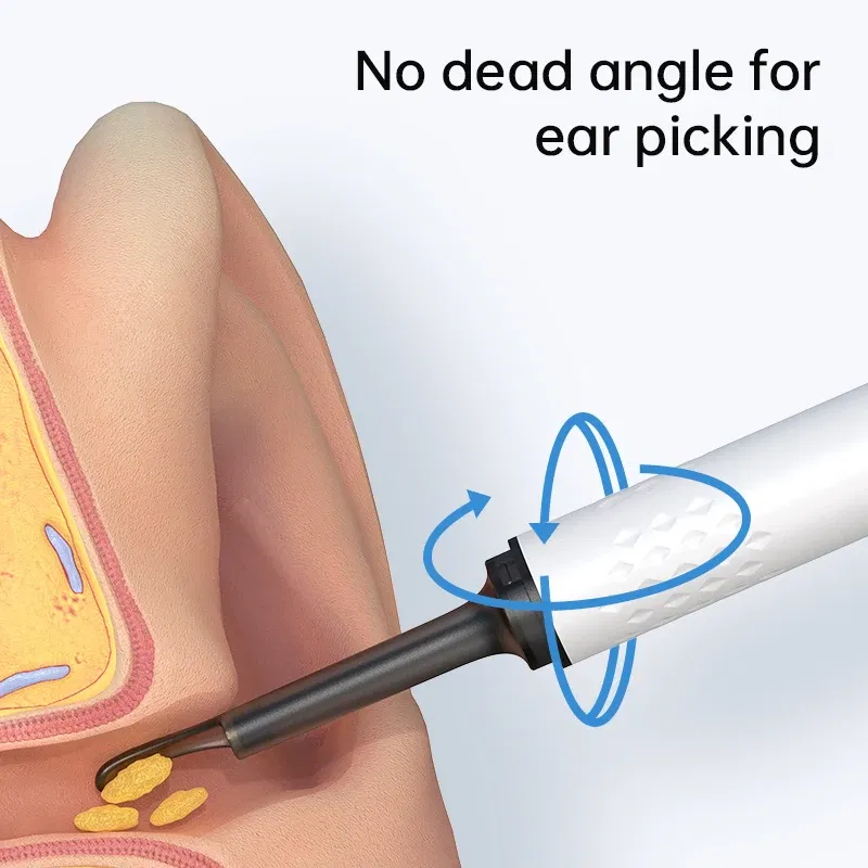 Color: Brown - Visual Ear Cleaner With Camera 6 LED Lights 4.0mm Lens Ear Wax Removal Tool ?‹500W Pixel Camera Take Video 500W HD Earpick Gifts