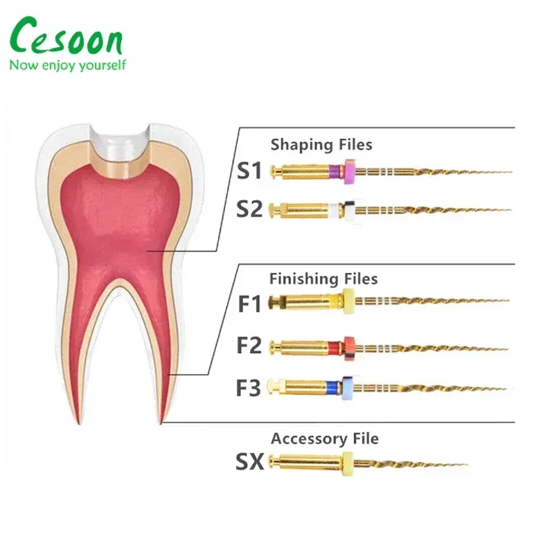 Color: Light Red - Dental Heat Activation Gold Flexible Files Endodontic Endo NITI Rotary File Nickel Titainium For Root Canal Dentistry Lab Tools