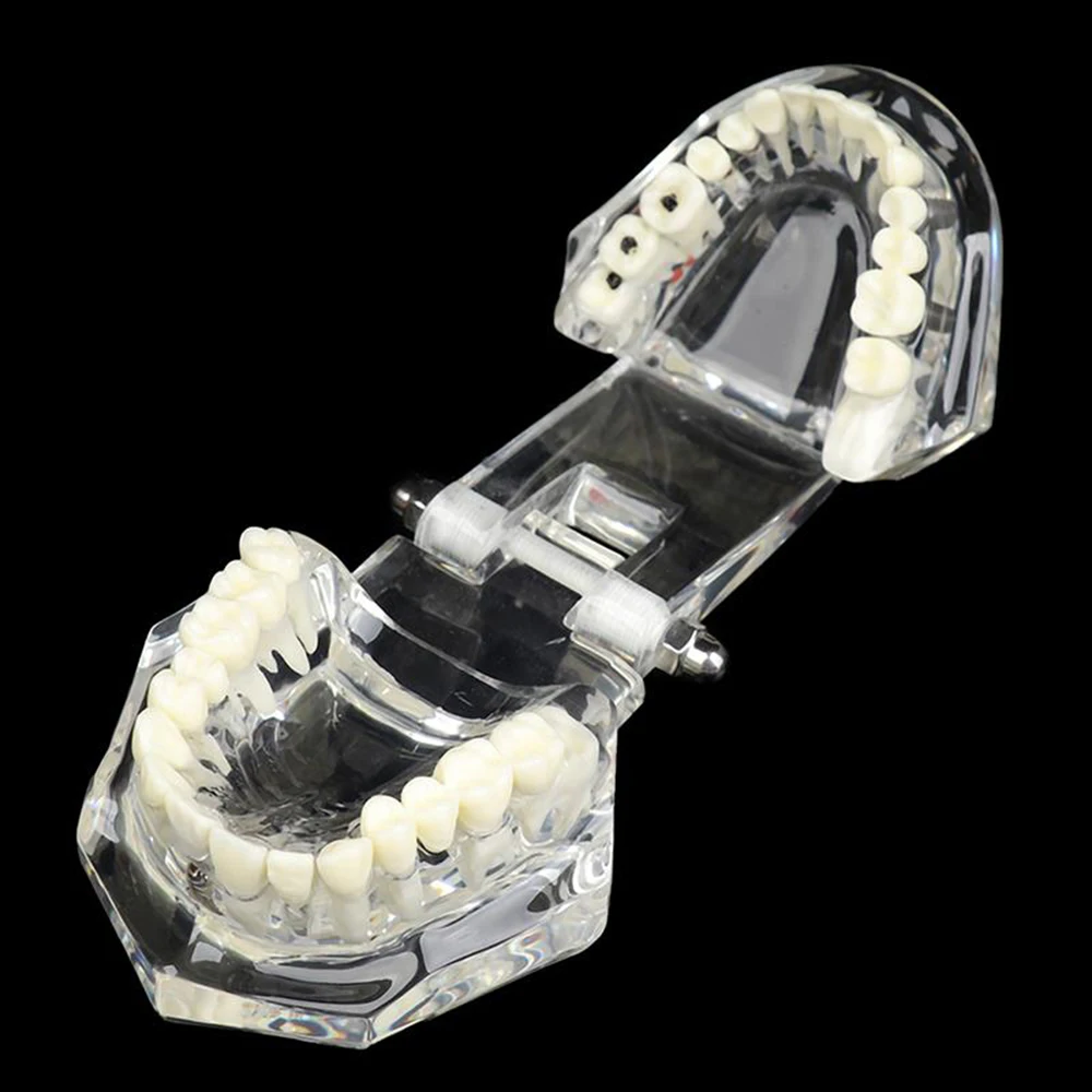 Dental Models Repairable Resin Models Of Diseased Teeth For Teaching And Research In Medicine And Dental Diseases