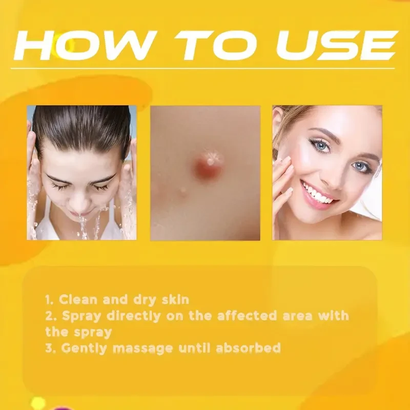 Gentle Bee Venom Skin Care Spray