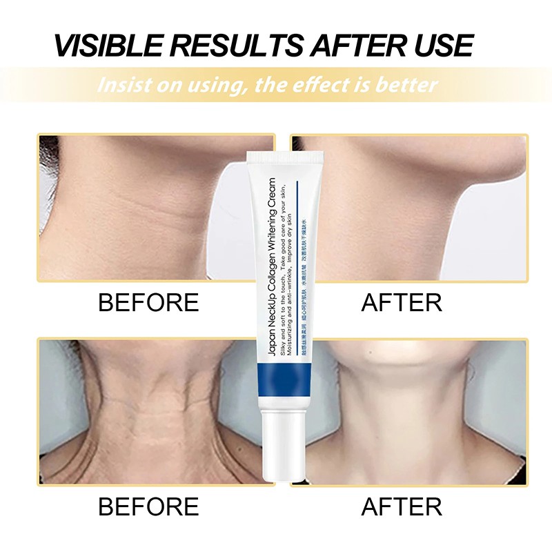 Collagen Protein Cream for Neck - Eliminate Fine Lines, Anti-ageing, Lift and Rejuvenate