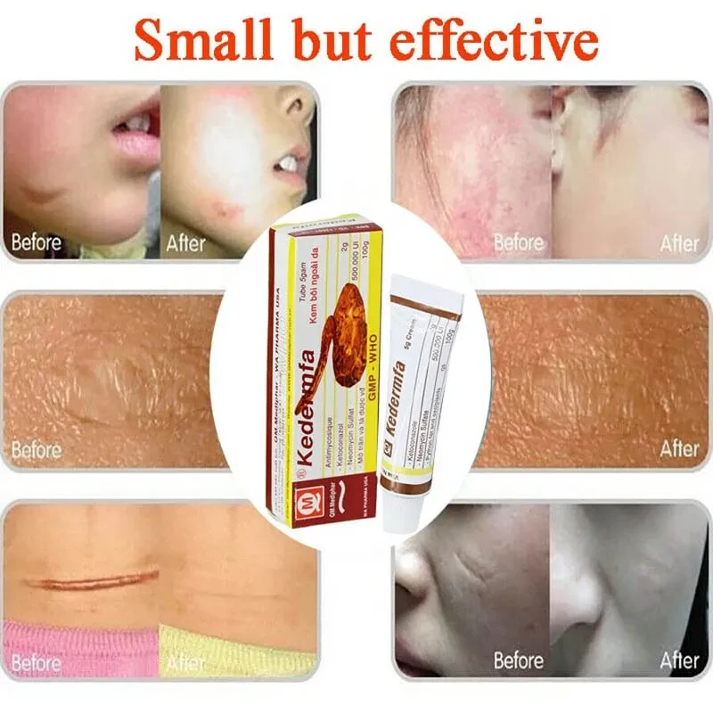 Original Snake Skin care lotion Hand Cream