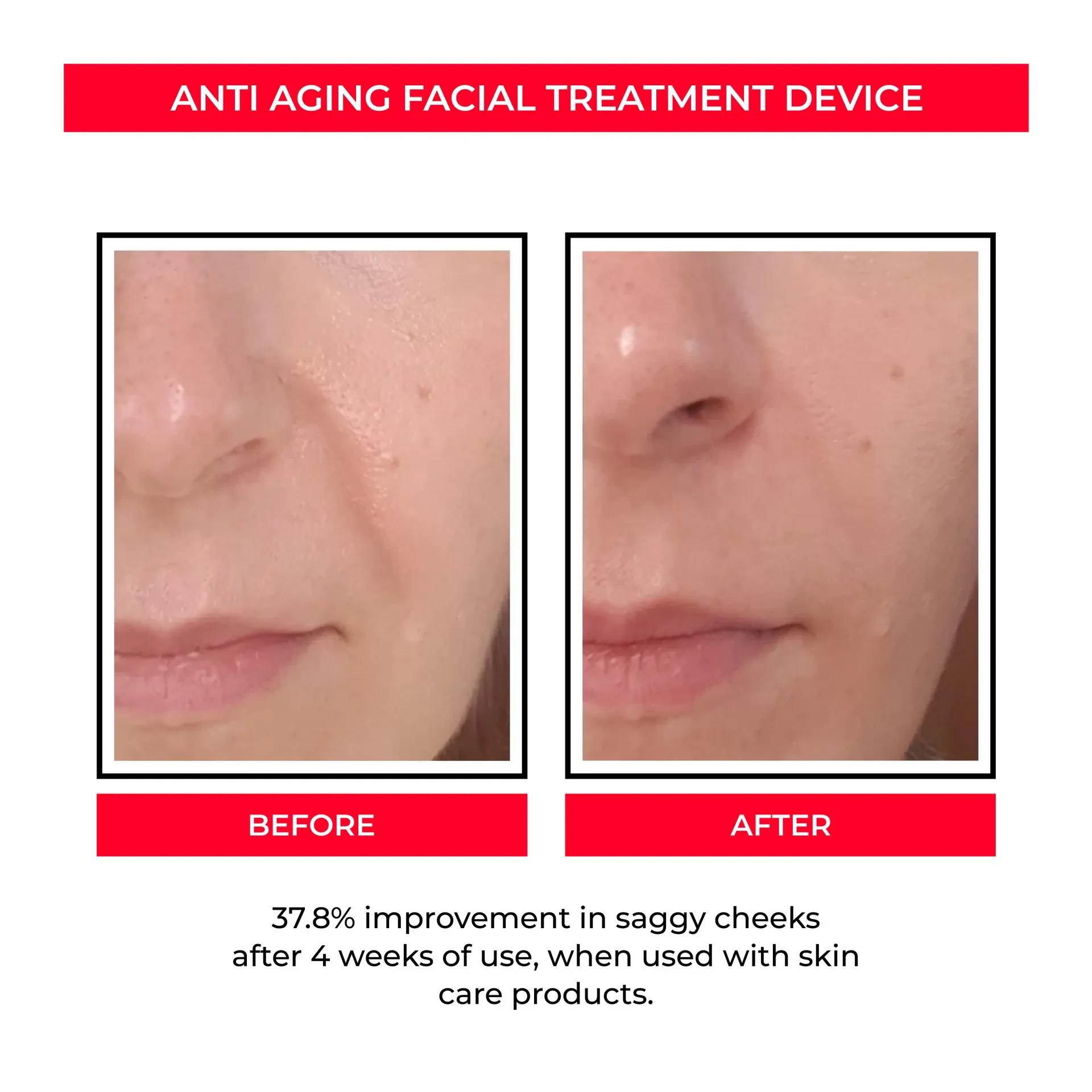 EMS Skin Rejuvenation Device with Microcurrent for Pore Tightening and Skin Firming
