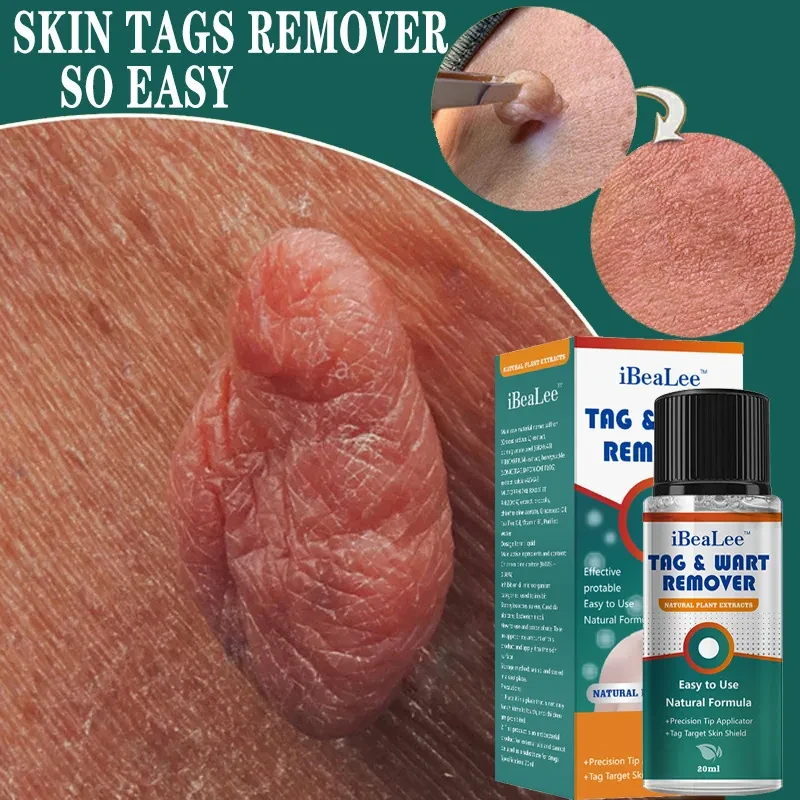Moisturizing Facial Wart Remover Liquid