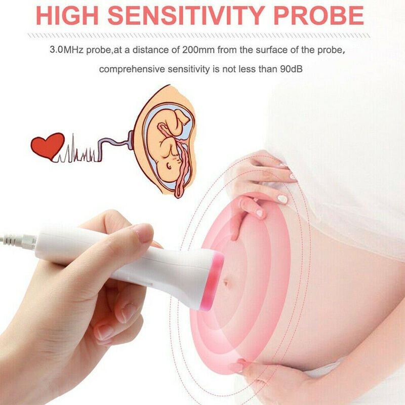 Fetal Doppler
