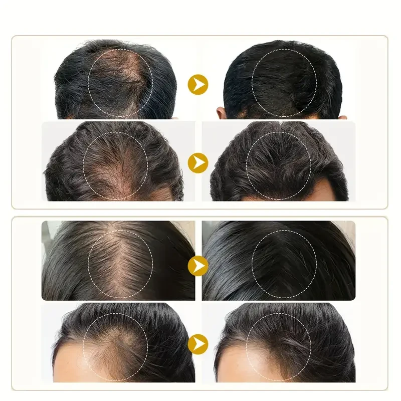 Hair Thicker Cream - Biotin & Vitamin-Enriched Hair Cream for Thicker, Longer, Fuller, Healthier Hair