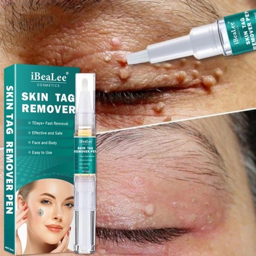Wart Flat Especially AcutenessKe You Cream Smooth Liquid