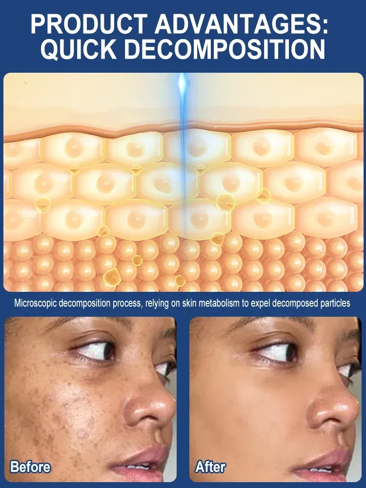 Color: black - ?โฆ?ยซ๐๐?ยค๐ฅ๐ ?ยซ๐?ยฆ๐จ๐ฏ๐๐ฅ Laser Therapy to Heal Spots