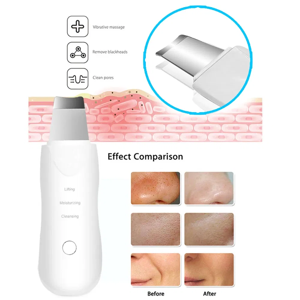 Color: Red - Ultrasonic Skin Scrubber Scrubber Deep Vibrate Facial Cleaner Shovel Face Scrubber Peeling Black Head Remover Facial Massager