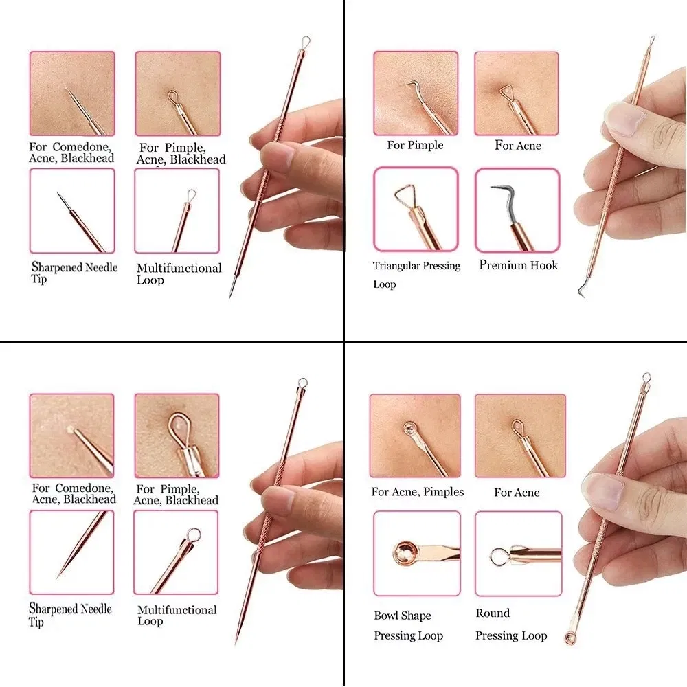 Color: Reseda - 4PCS Stainless Steel Acne Needle Electroplating Colorful Rose Gold Acne Needle Extrusion Blackhead Tool Can Be Customized LOGO