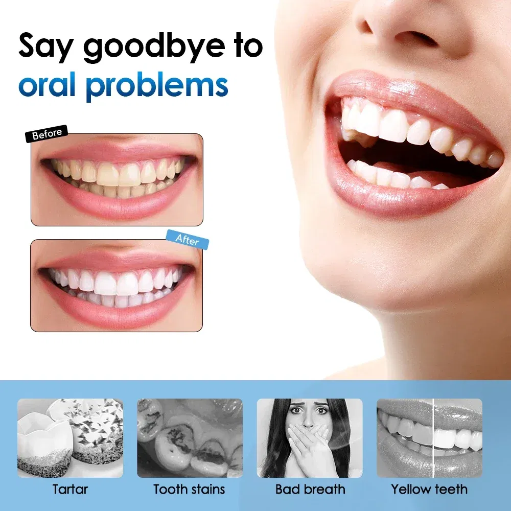 Color: Blue - Electric Sonic Vibration Toothbrush Dental Scaler Teeth Whitening Plaque Calculus Coffee Smoke Stains Tartar Removal Tooth Clean